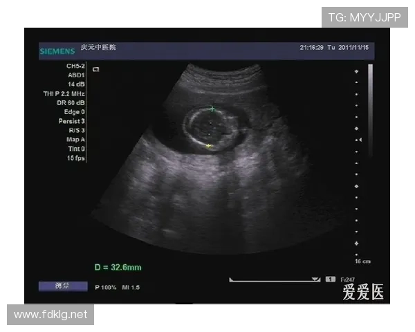 医学中b超中mt(b超 mt)世界杯体育论坛 医学中b超中mt(b超 mt)世界杯体育论坛